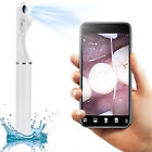 Dental Intraoral Camera Flosser - Oral Endoscope with LED lights, Oral cleaning