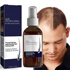 New Blusoms Hairgrowth Formula Serum Spray, Ashwagandha 4500 Hair Growth Spray