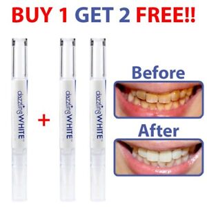 New PEROXIDE Teeth Whitening Gel Pen Strong Tooth Whitener Stain Remover Instant