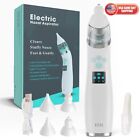 Electric Baby Kids Nasal Aspirator Nose Automatic Booger Sucker Cleaner Nose
