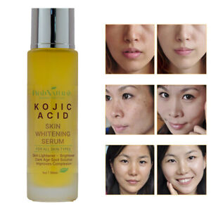 KOJIC ACID Skin Whitening Lightening Brightening Serum Bleaching/Spot Fade Cream