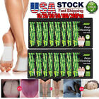 300PCS Detox Foot Patches Pads Body Toxins Feet Slimming Deep Cleansing Herbal