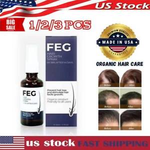 FEG Organic Anti Hair Loss Hair Growth Cure Oil For Thicker Long Hair  50ml