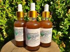 Aloe Vera + Avocado Oil for Hair and Skin Repair Dry Itchy Scalp FAST Growth