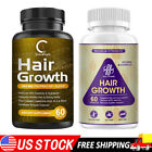 Advanced Anti Hair Loss Capsules DHT Blocker Fast Hair Growth Vitamins 5000mg