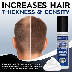 5% Minoxidil Foam for Men Hair Regrowth Treatment Biotin & Vitamins (1 Month)