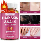 Hair, Skin and Nails Gummies - with Biotin and Collagen - Promote Hair Growth