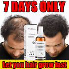 100ml Anti-Shedding Hair Spray Anti Hair Loss Serum Dense Fast Hair Growth Spray
