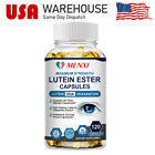Lutein Ester Capsules Eye's Health Supplement for Vision Care Visual Health