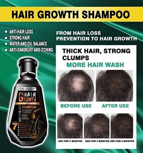 REGAIN GROWTH GROW HAIR LOSS REGROWTH SHAMPOO no rogaine finasteride side effect