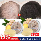 2PACK Ginger Hair Regrowth Shampoo Bar Hair Growth Soap Anti Hair Loss Treatment