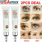 2Pcs Magic Eye Cream-28 seconds to remove eye bags / dark circles / eye wrinkles