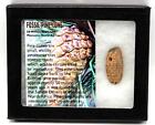Pine Cone Fossil w/ Display Box & COA 16780