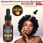 Allurium Beauty Hair Growth Serum For Black Women, Anti Hair Loss Nourish Hair