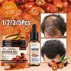 5/3X Natural Batana Oil For Hair Growth Anti Hair Loss Treatments For Men&Women