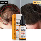 100% Natural Batana Oil For Hair Growth Anti Hair Loss Treatments For Men&Women