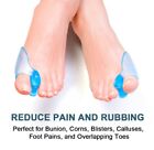 1-Pair Silicone Gel Bunion Corrector & Toe Separator - Orthotic Pain Relief