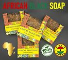 1 lb- 16oz Raw African Black Soap Bar 100% Pure Natural Organic Ghana Bulk BEST!
