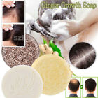 Rice Ginger Hair Regrowth Shampoo Bar Soap Fast Hair Growth Anti Hair Loss Serum