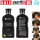 DEXE 200ml Anti-Hair Loss Shampoo Promote Hair Growth Shampoo for Men & Women US