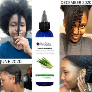 Fast Ayuverdic Hair Growth Oil for Alopecia with Fenugreek, Aloe & Moringa,4 oz