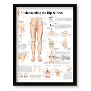 Medical Poster Understanding The Hip & Knee, Poster 22x28 Wall Diagram