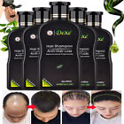 DEXE Anti-Hair Loss Shampoo Promote Hair Growth Shampoo for Men & Women 200ml US