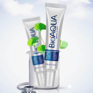 BIOAQUA Face Skin Care Acne Treatment Removal Cream Spots Scar Blemish Marks