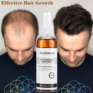 Anti-Shedding Hair Spray Hair Loss Treatment Solution Hair Growth Spray For Men