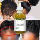 Pure Oil Hair Growth Fast Hair Growth Oil African Traction Alopecia Serum 60ml