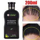 New ListingHair Growth Shampoo Hair Thickening Shampoo Hair Loss Treatment for Men & Women