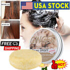 Rice & Ginger Hair Regrowth Shampoo Bar Soap, Fast Hair Growth, Anti Hair Loss